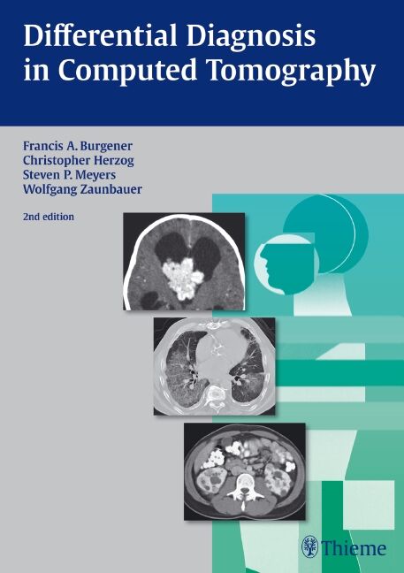 Differential Diagnosis in Computed Tomography, 9783132579118