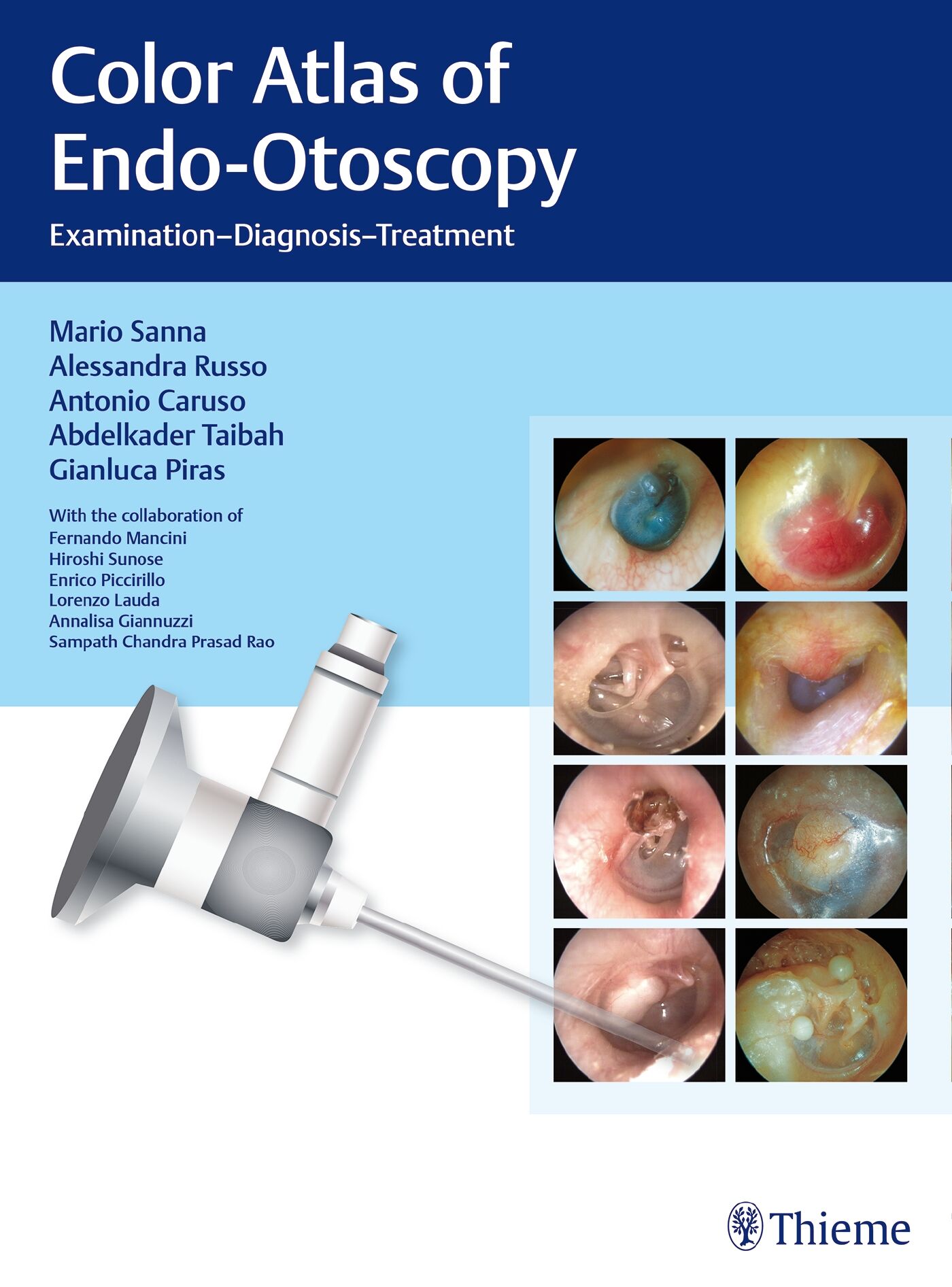Color Atlas of Endo-Otoscopy, 9783132415232