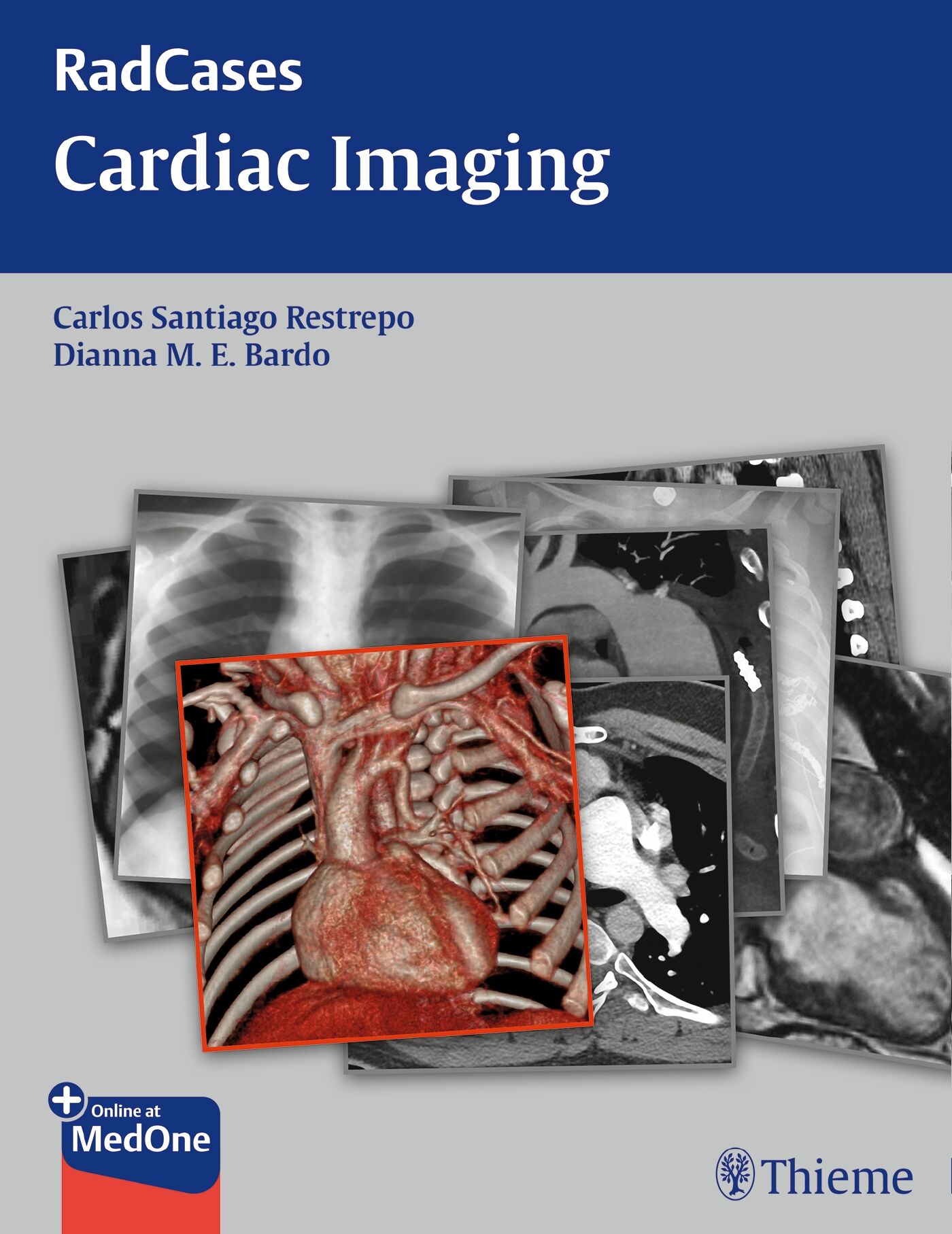 Radcases Cardiac Imaging, 9781604061864