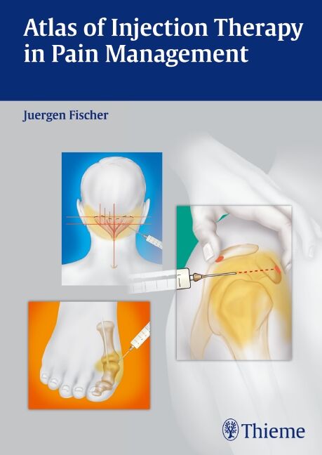 Atlas of Injection Therapy in Pain Management, 9783131543011