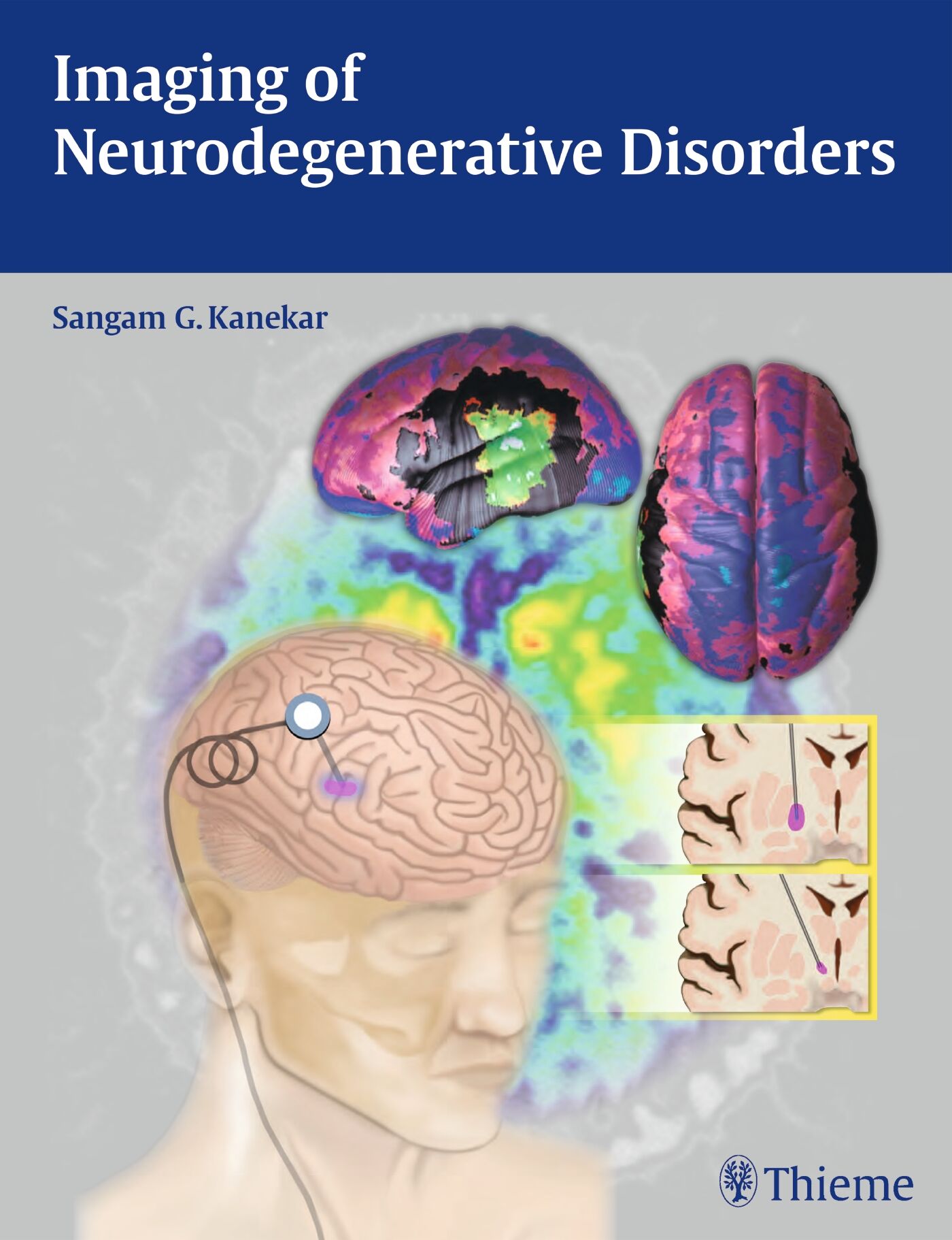 Imaging of Neurodegenerative Disorders, 9781604068542