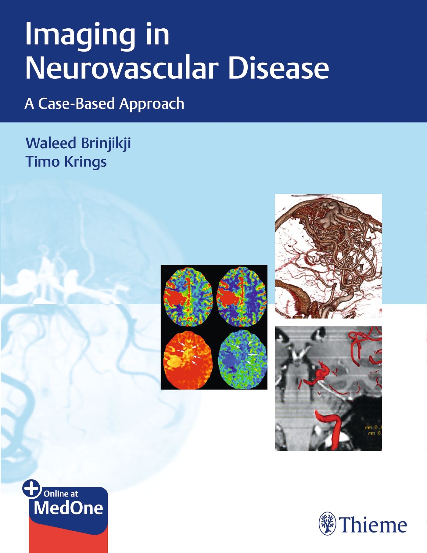 Imaging in Neurovascular Disease, 9781638536406