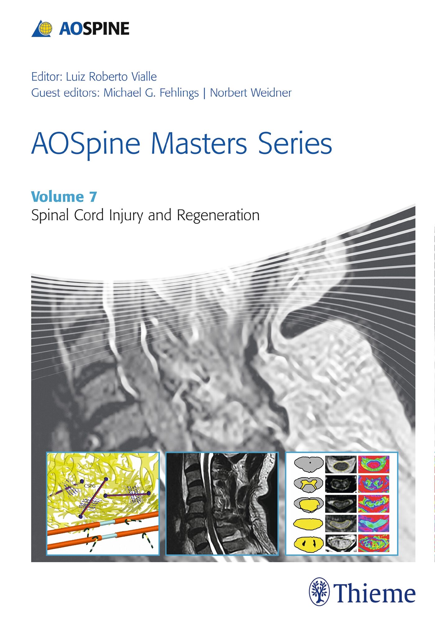 AOSpine Masters Series, Volume 7: Spinal Cord Injury and Regeneration, 9781626232273