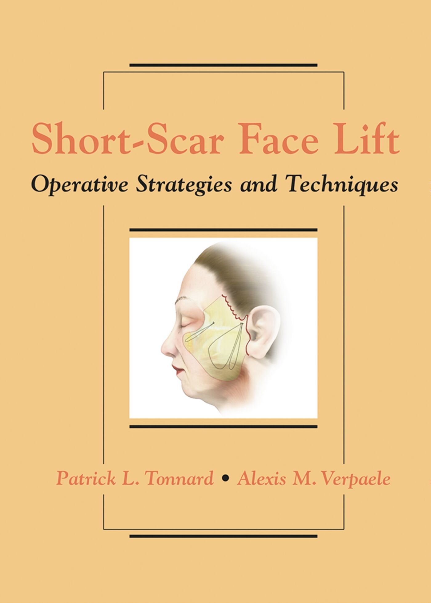 Short-Scar Face Lift, 9781626236325