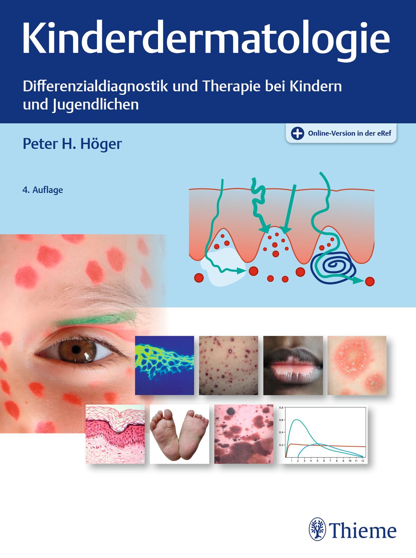 Kinderdermatologie, 9783132420663