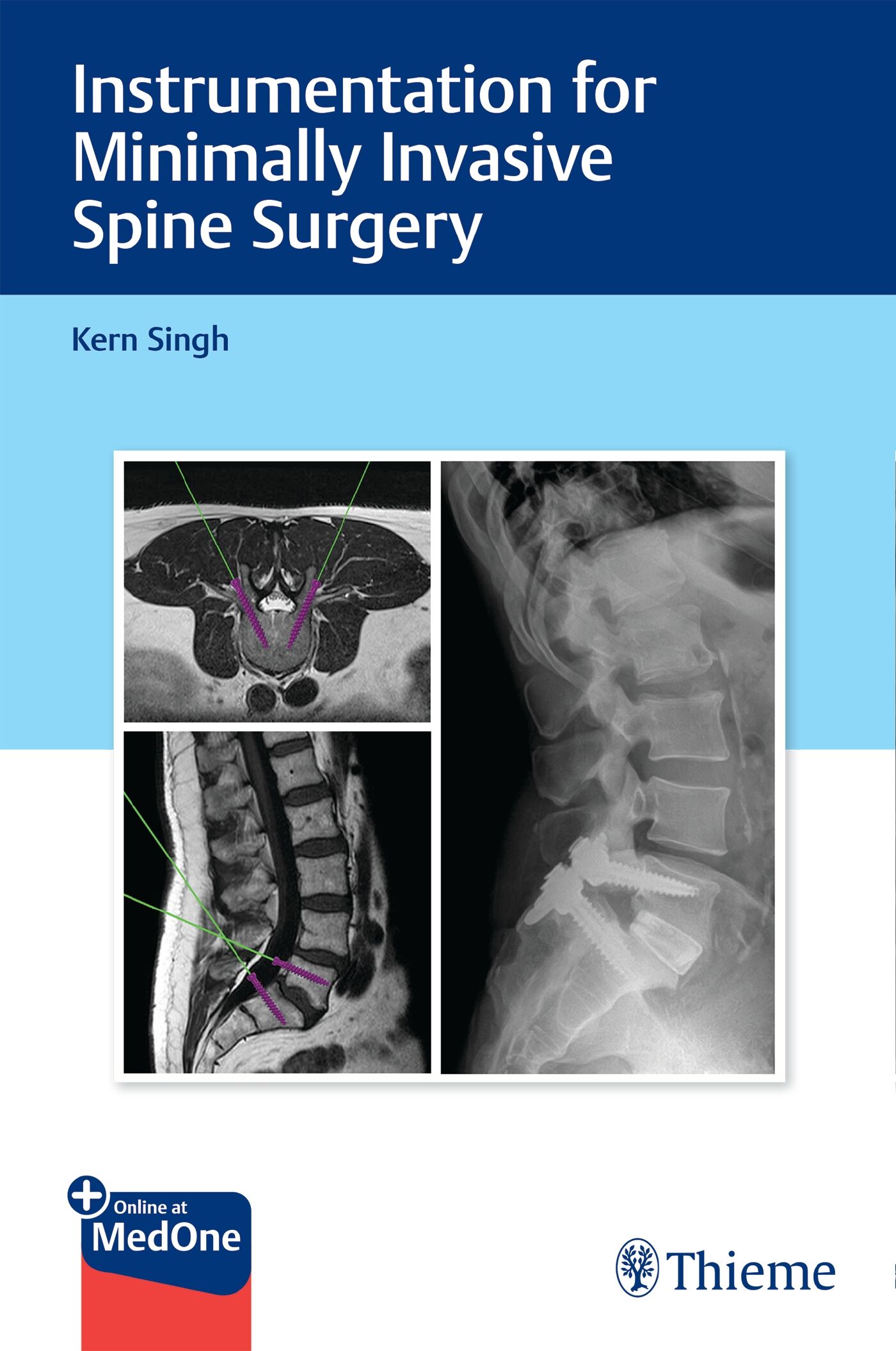 Instrumentation for Minimally Invasive Spine Surgery, 9781626232020
