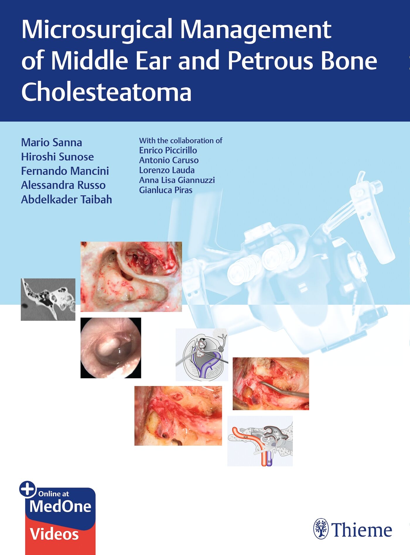 Microsurgical Management of Middle Ear and Petrous Bone Cholesteatoma, 9783132582590