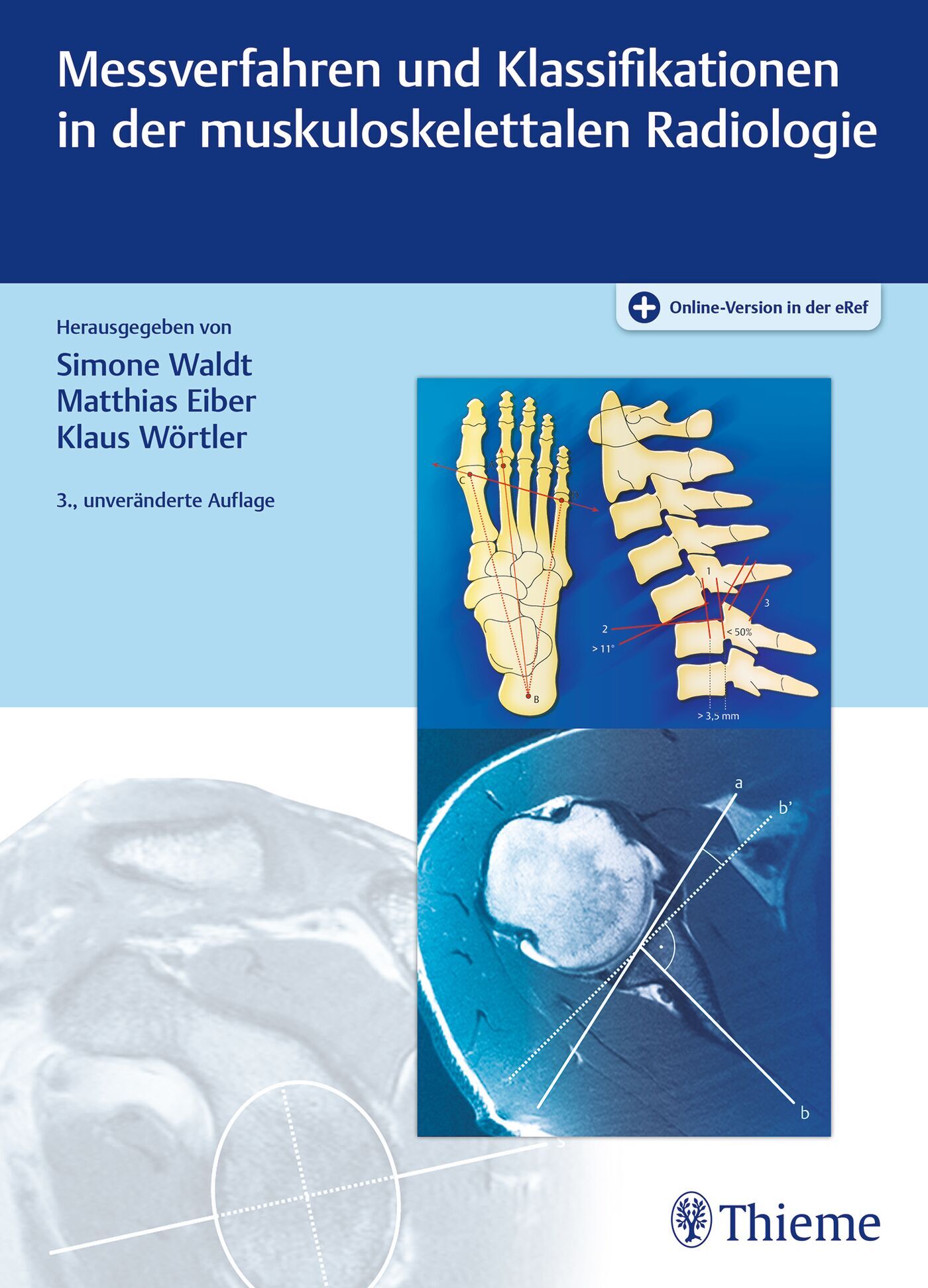 Messverfahren und Klassifikationen in der muskuloskelettalen Radiologie, 9783132454668