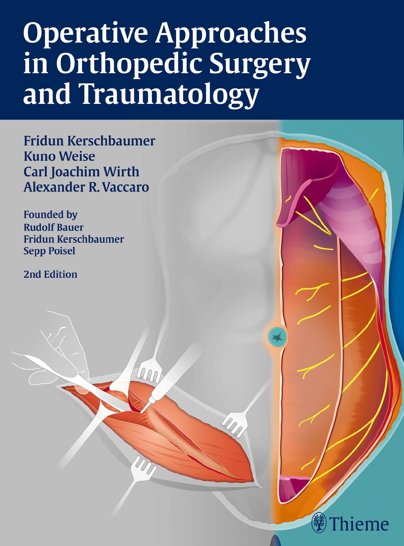 Operative Approaches in Orthopedic Surgery and Traumatology, 9783137055020