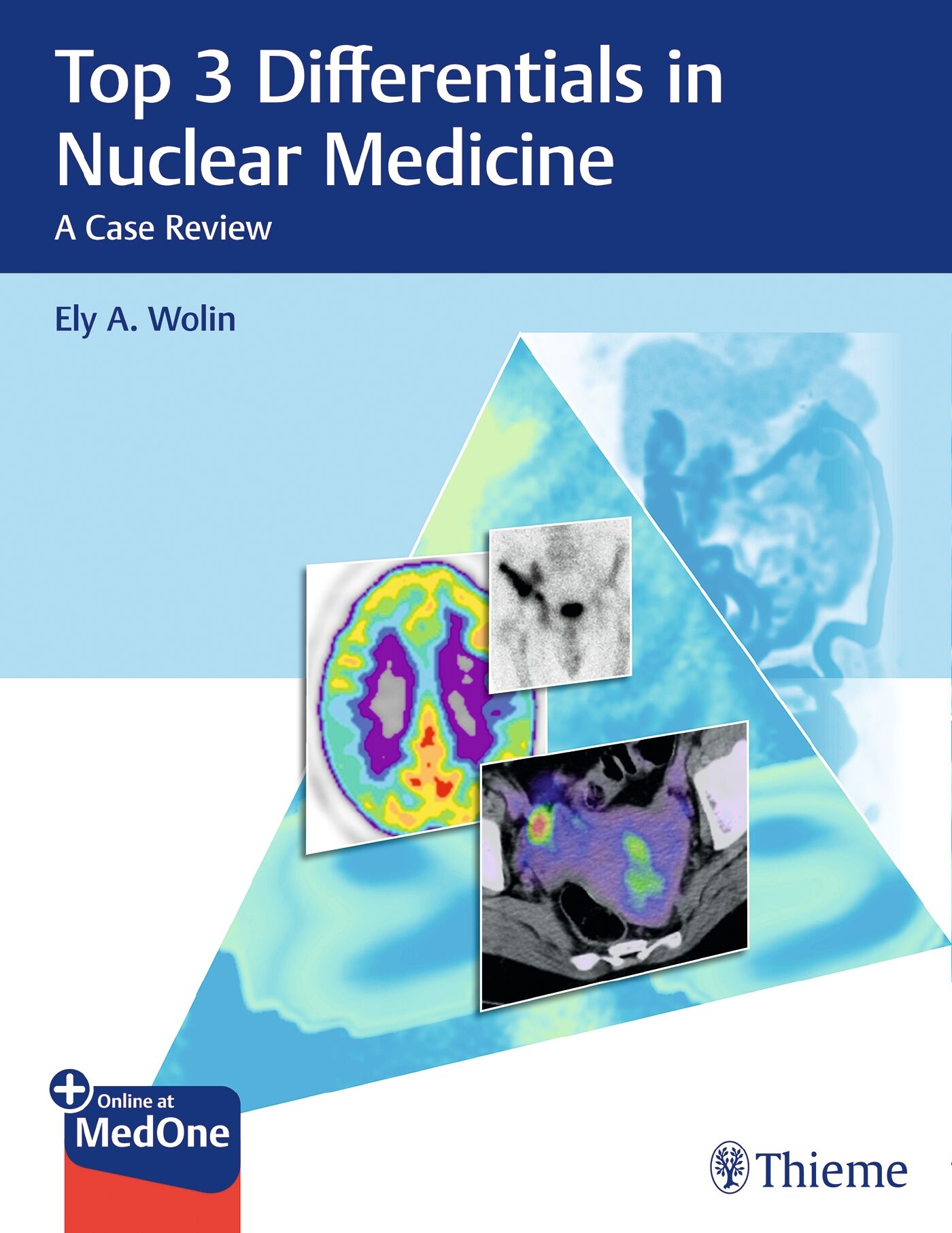 Top 3 Differentials in Nuclear Medicine, 9781626233447