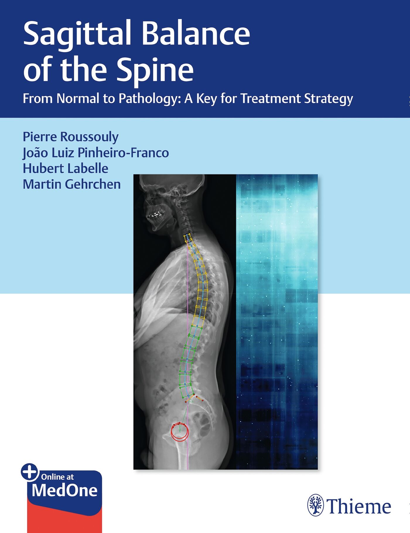 Sagittal Balance of the Spine, 9781626237322