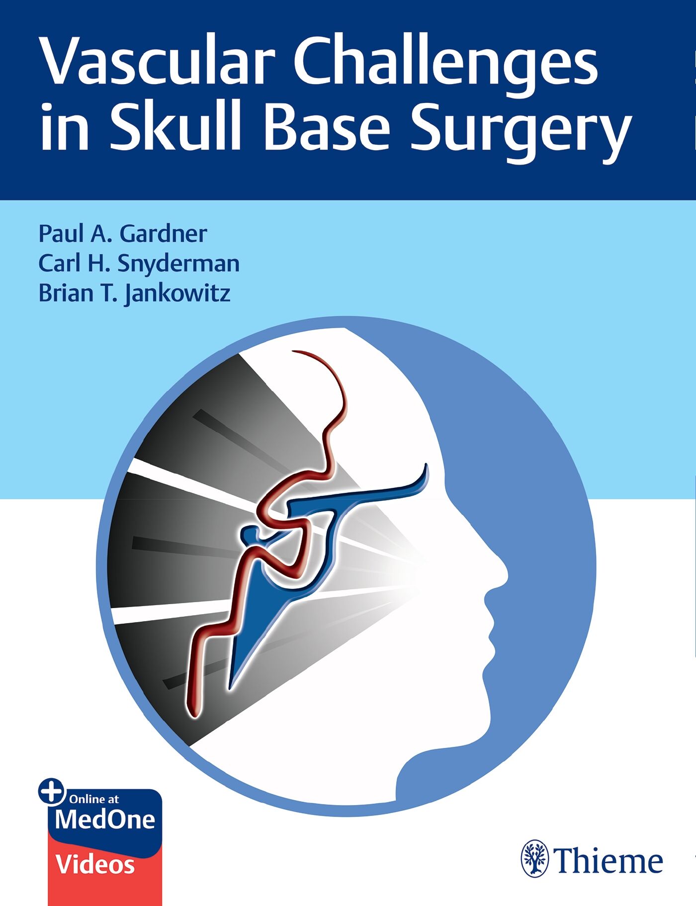 Vascular Challenges in Skull Base Surgery, 9781684200689