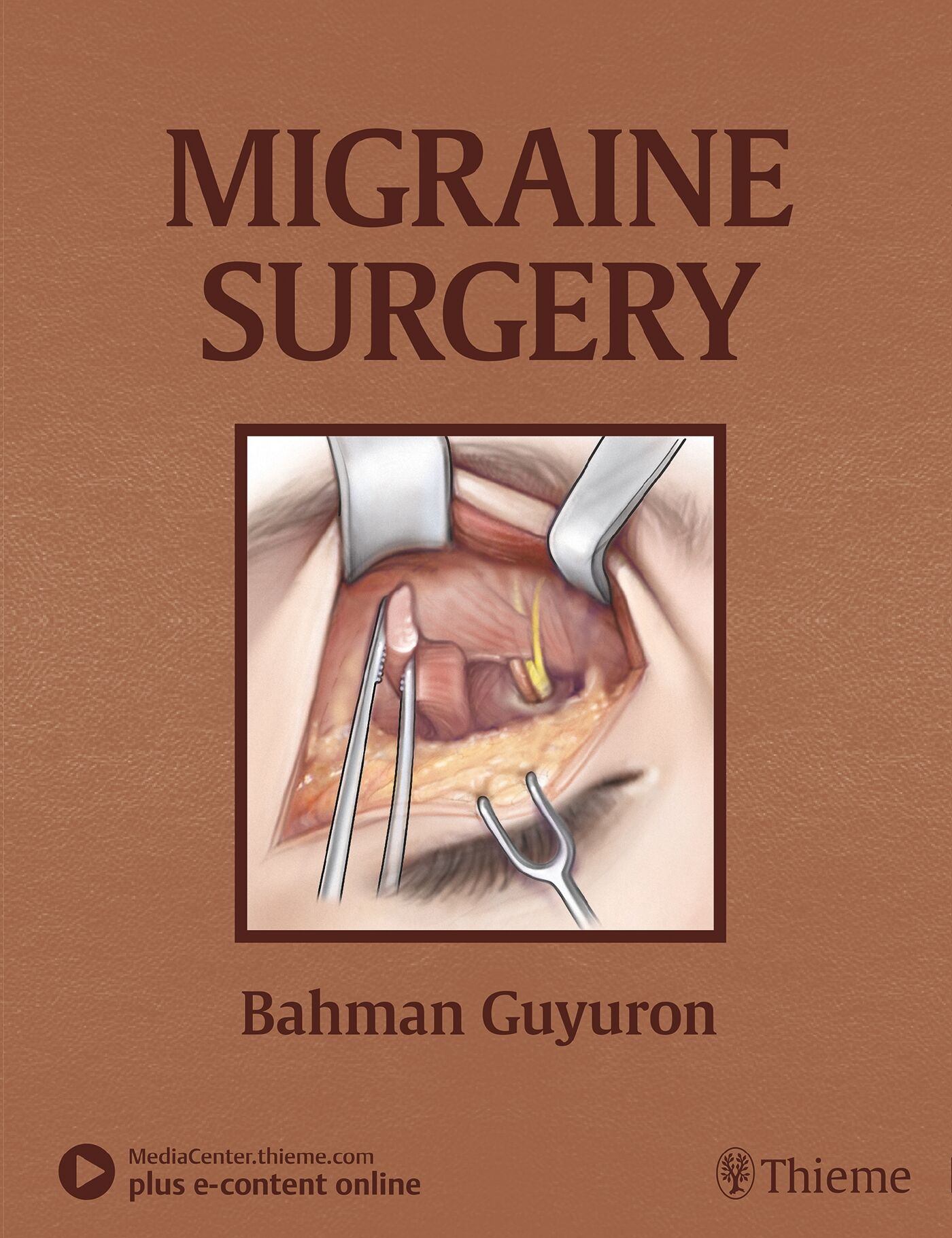 Migraine Surgery, 9781626236929
