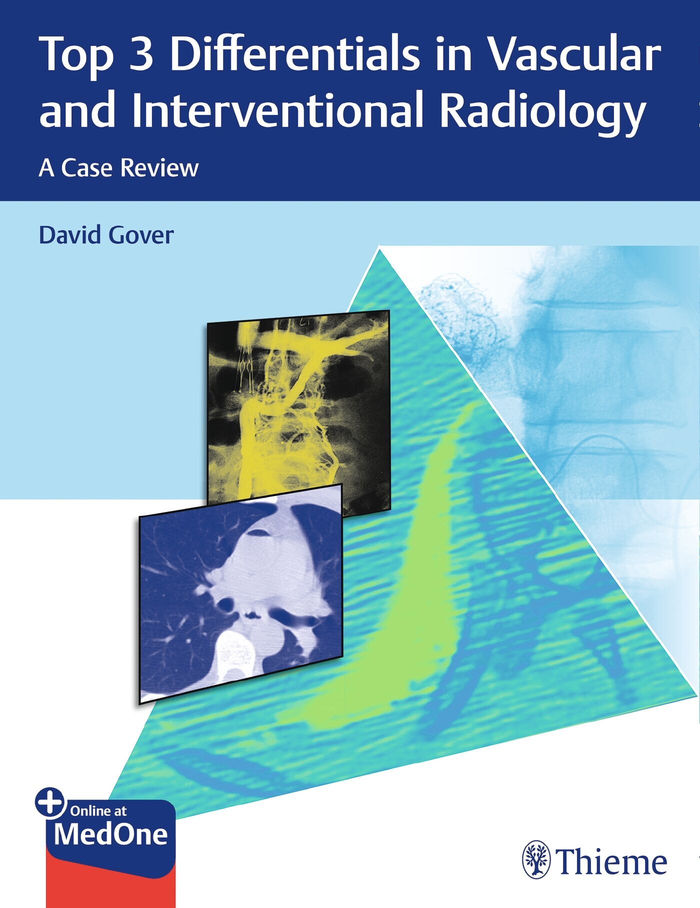 Top 3 Differentials in Vascular and Interventional Radiology, 9781626233560