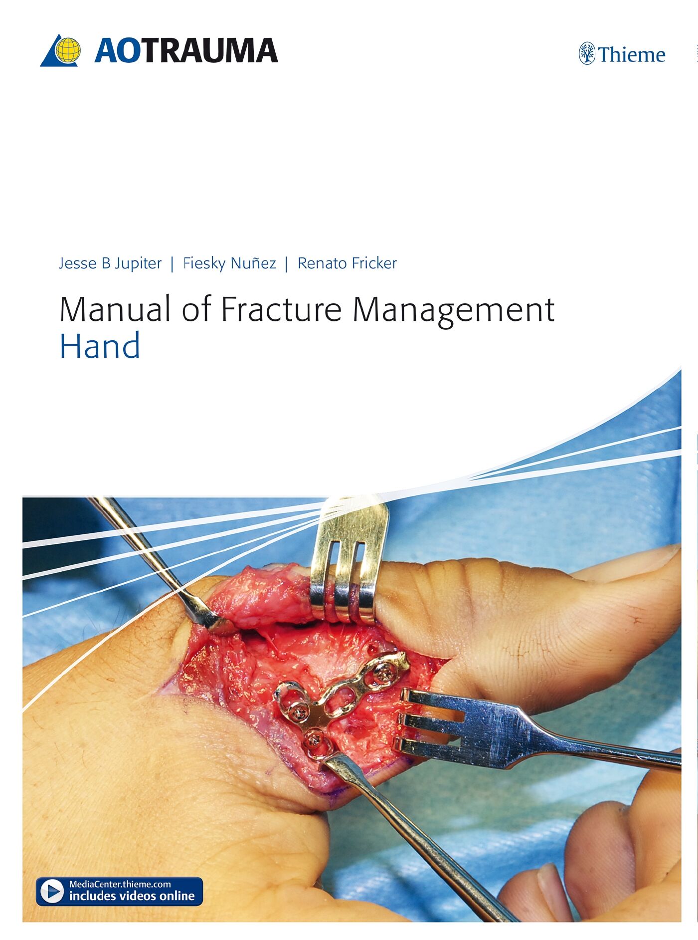 Manual of Fracture Management - Hand, 9783132215818