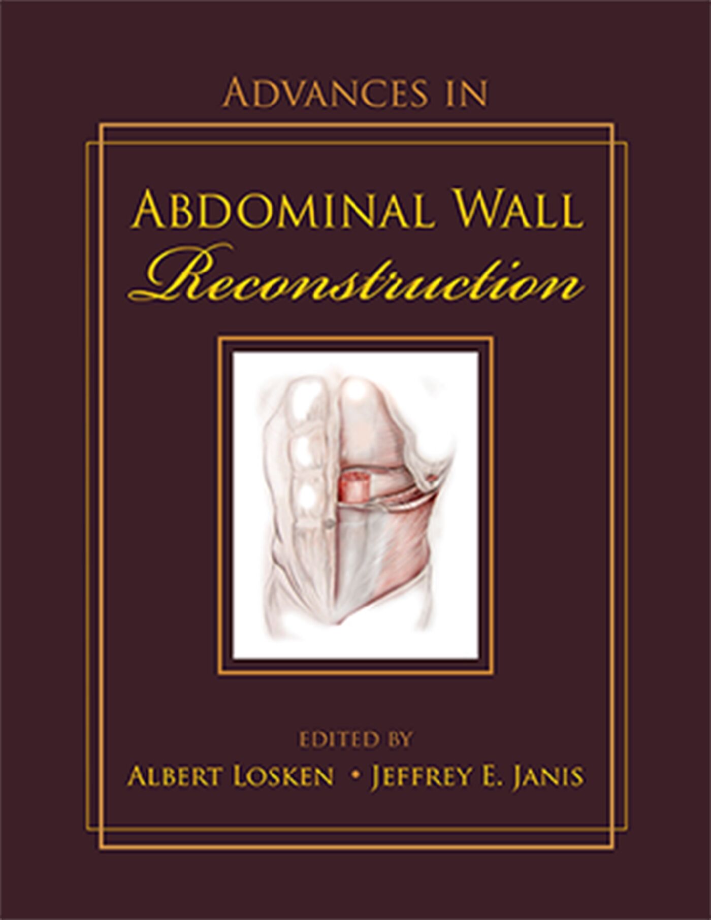 Advances in Abdominal Wall Reconstruction, 9781626236189
