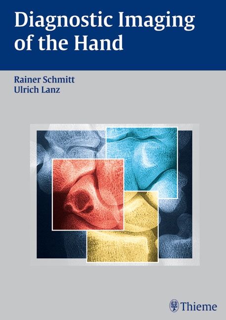 Diagnostic Imaging of the Hand, 9783131619419