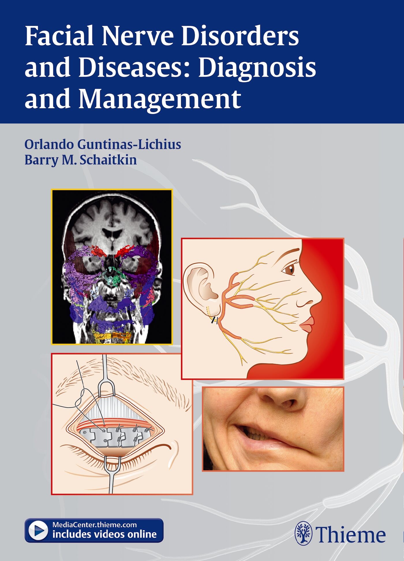 Facial Nerve Disorders and Diseases: Diagnosis and Management, 9783131751812