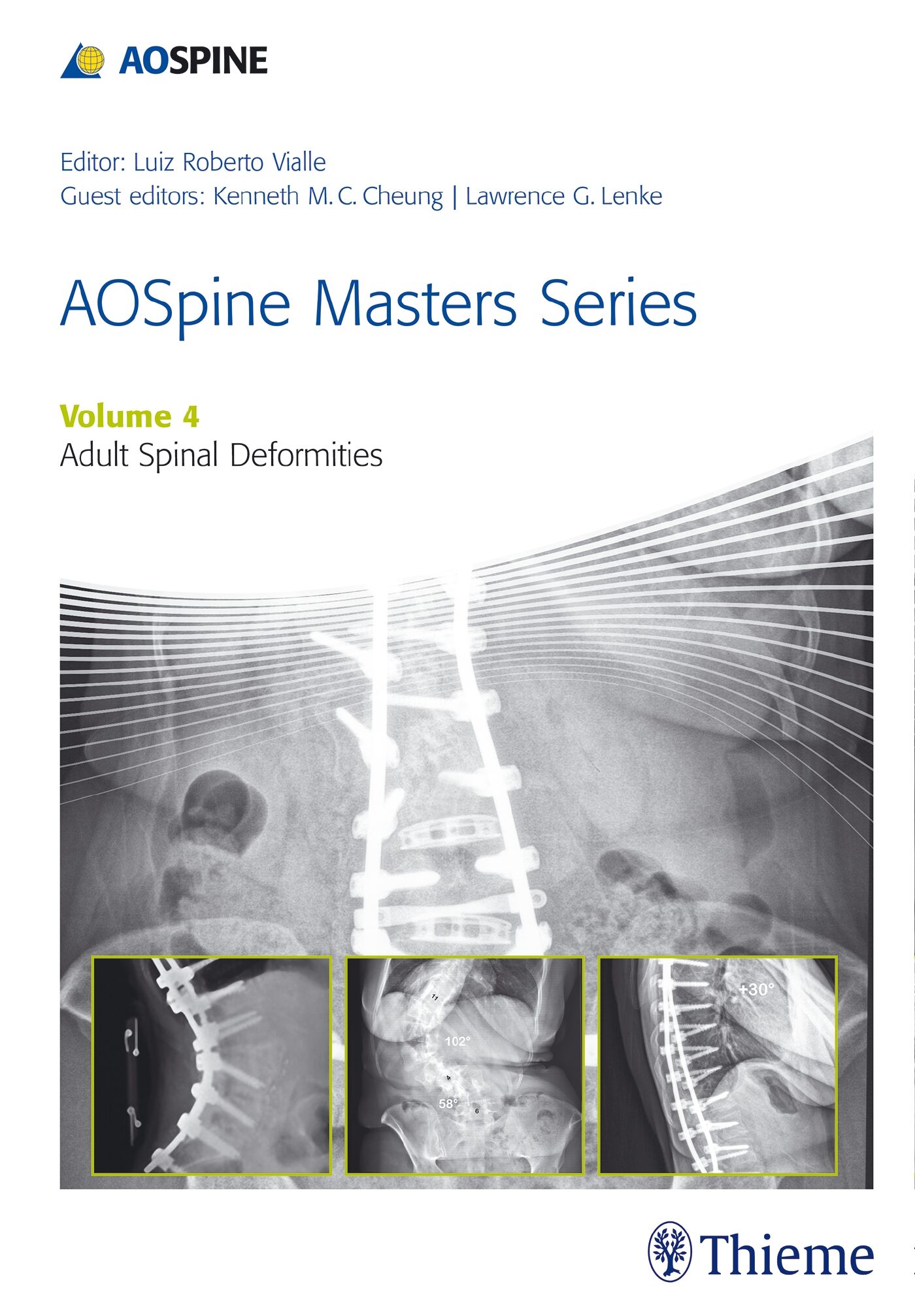 AOSpine Master Series, Vol. 4: Adult Spinal Deformities, 9781626231009