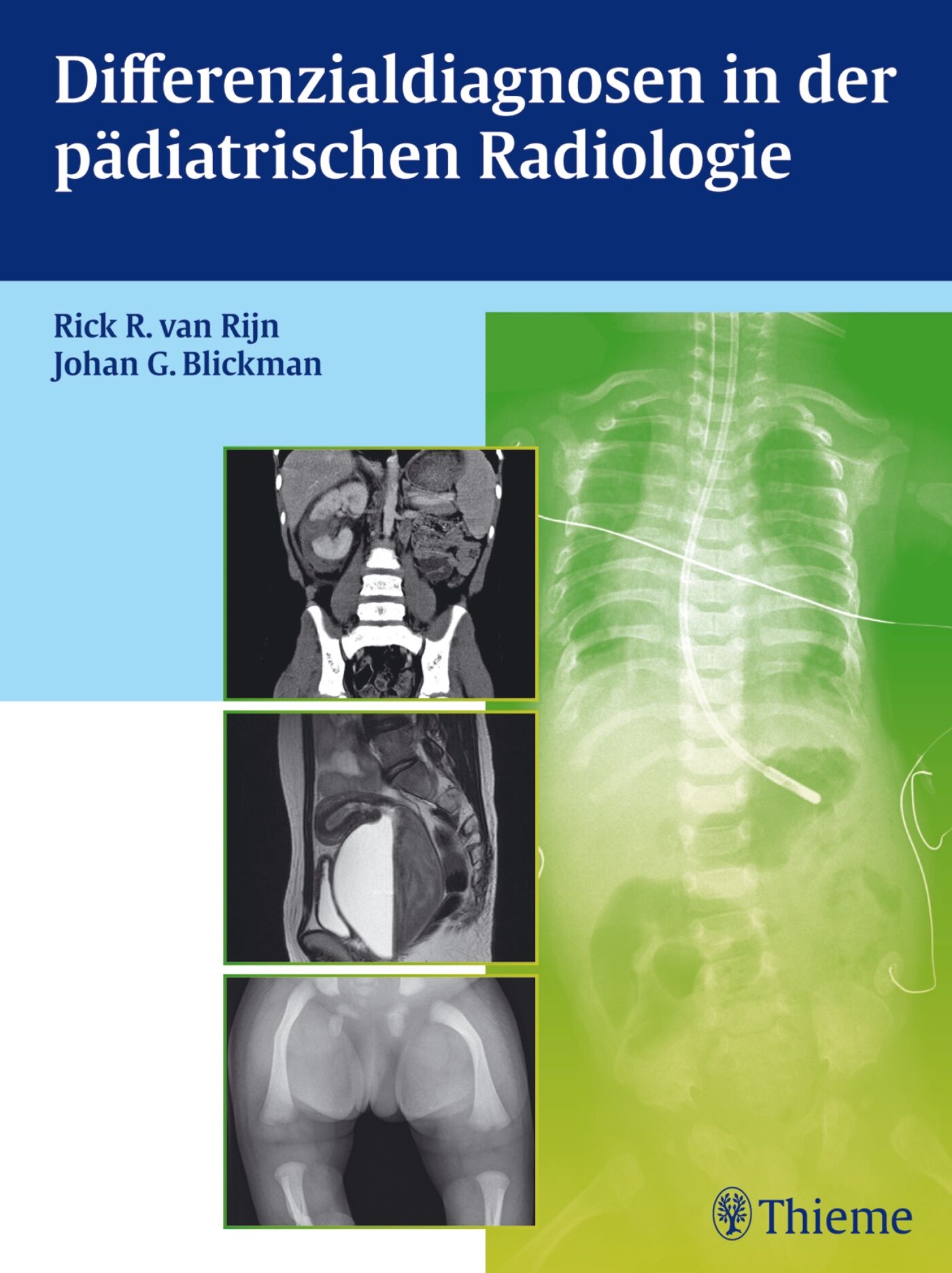 Differenzialdiagnosen in der pädiatrischen Radiologie, 9783131695819