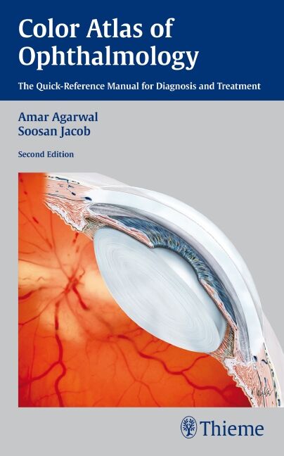 Color Atlas of Ophthalmology, 9781604062113