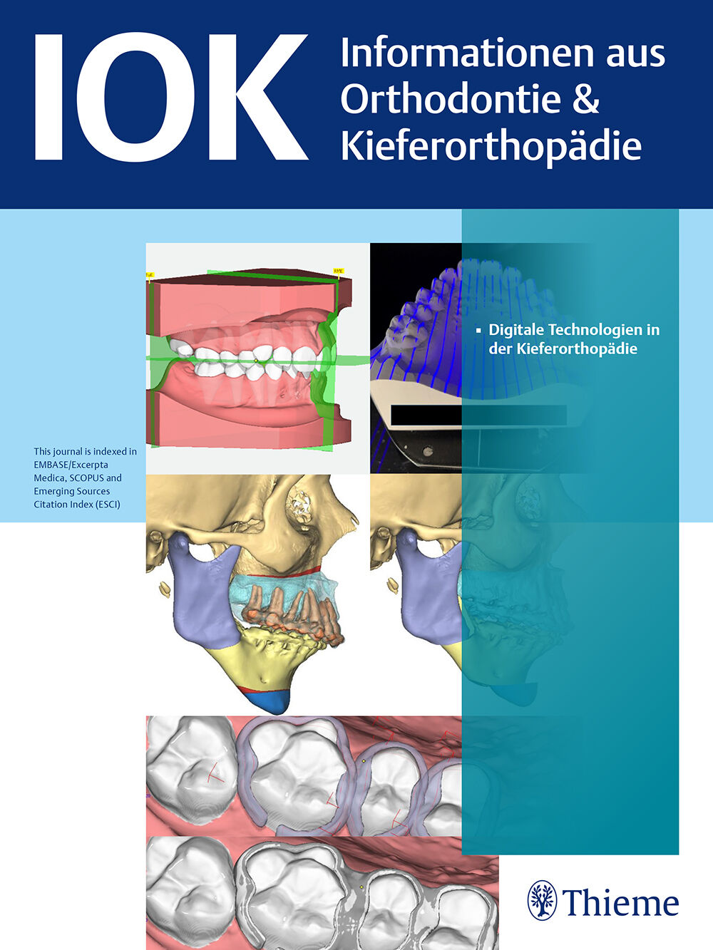 IOK   Informationen aus Orthodontie & Kieferorthopädie, 0020-0336