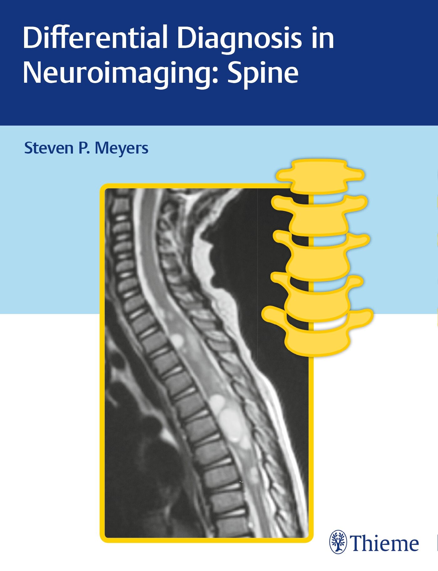 Differential Diagnosis in Neuroimaging: Spine, 9781626234772