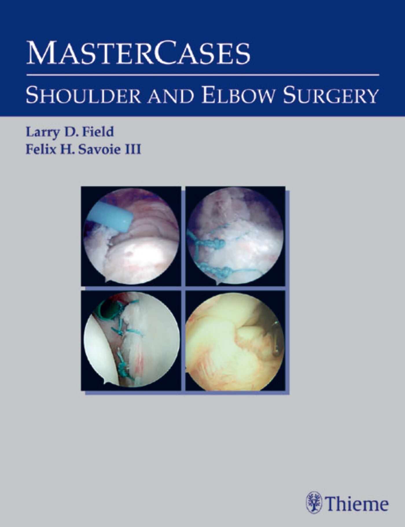 MasterCases in Shoulder and Elbow Surgery, 9780865778733