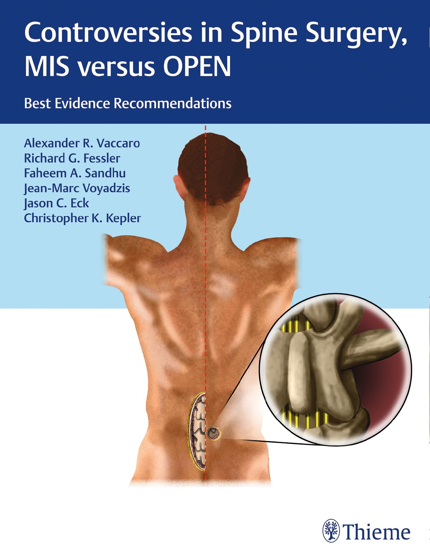 Controversies in Spine Surgery, MIS versus OPEN, 9781604068818
