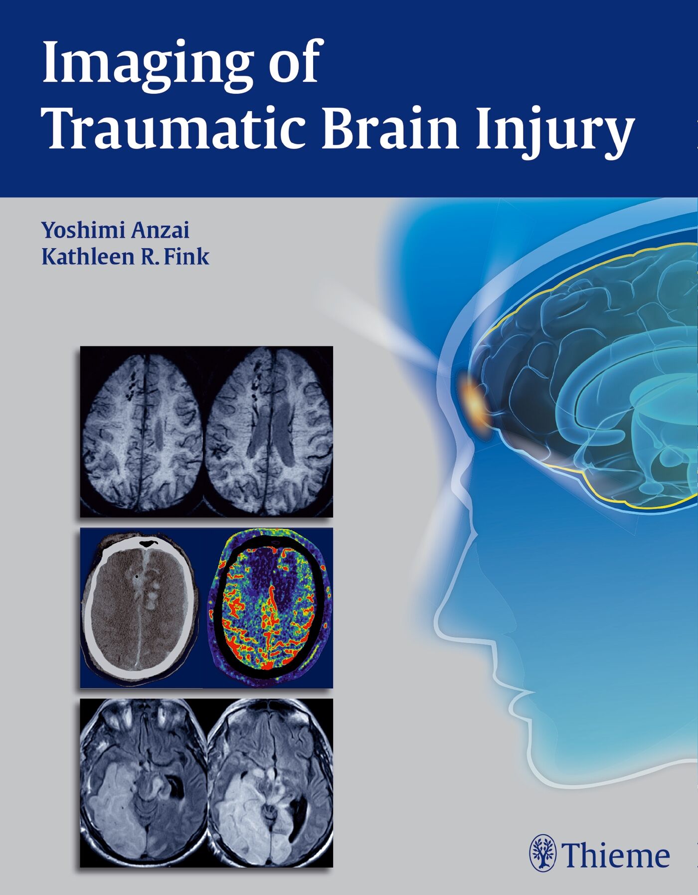 Imaging of Traumatic Brain Injury, 9781604067286