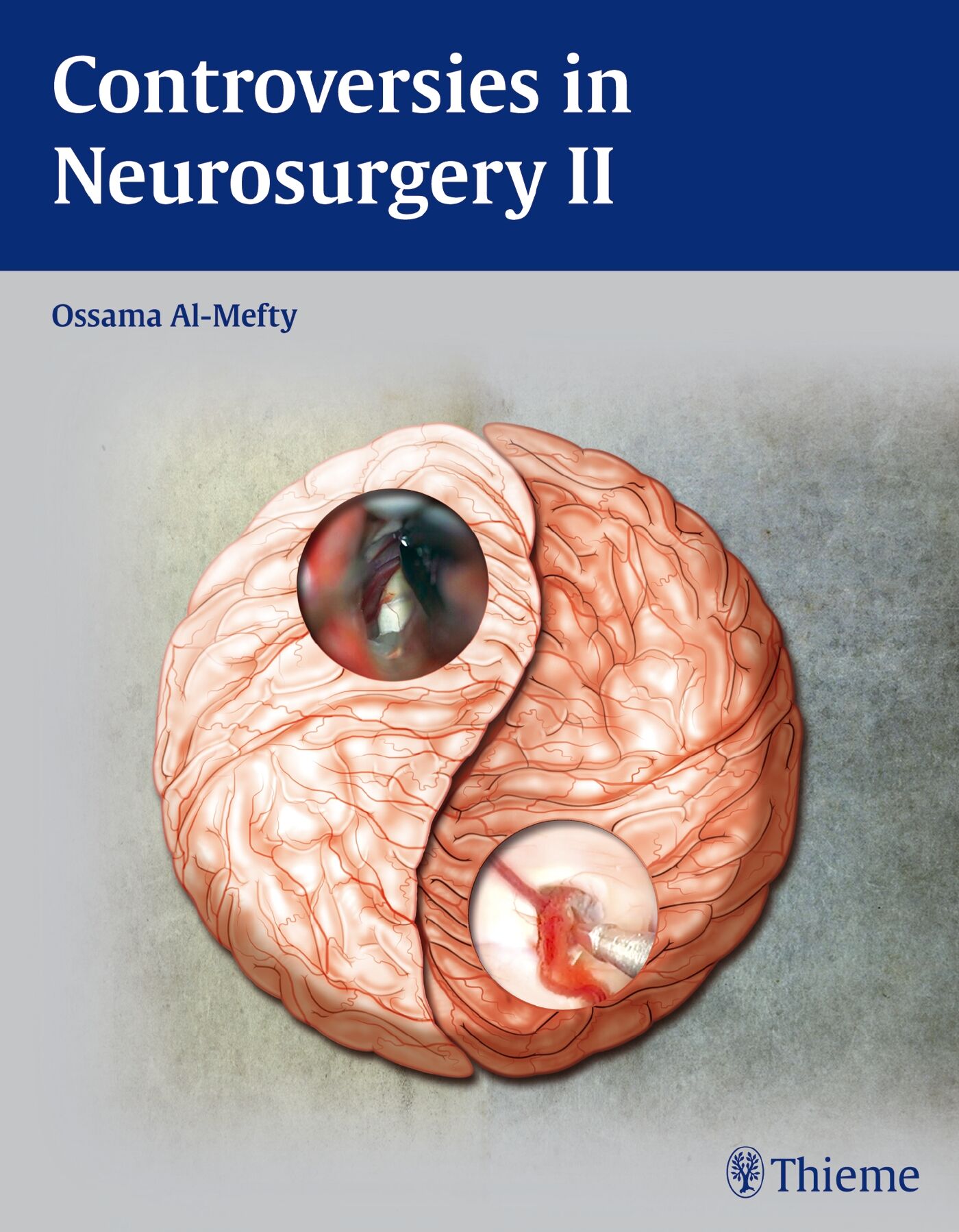 Controversies in Neurosurgery II, 9781604062328