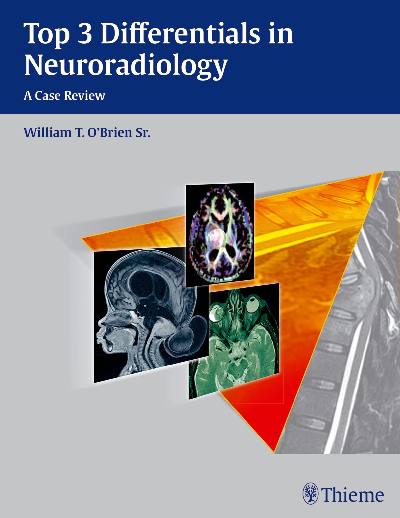 Top 3 Differentials in Neuroradiology, 9781604067231