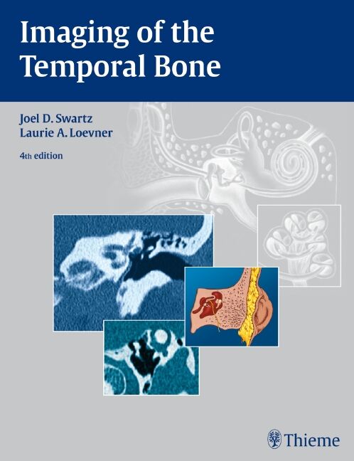 Imaging of the Temporal Bone, 9781588903457