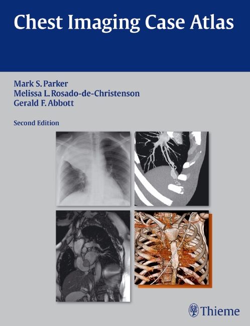 Chest Imaging Case Atlas, 9781604065909