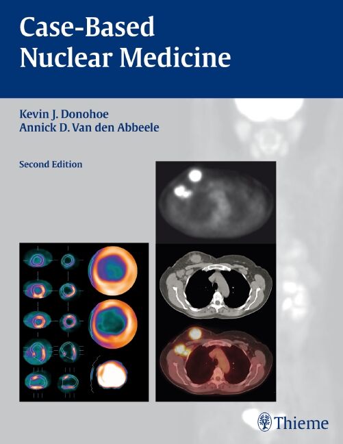 Case-Based Nuclear Medicine, 9781588906526
