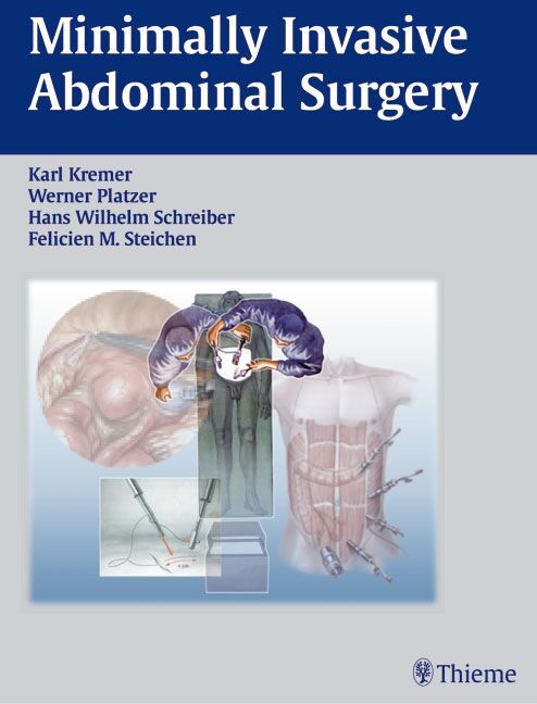 Minimally Invasive Abdominal Surgery, 9783131081919