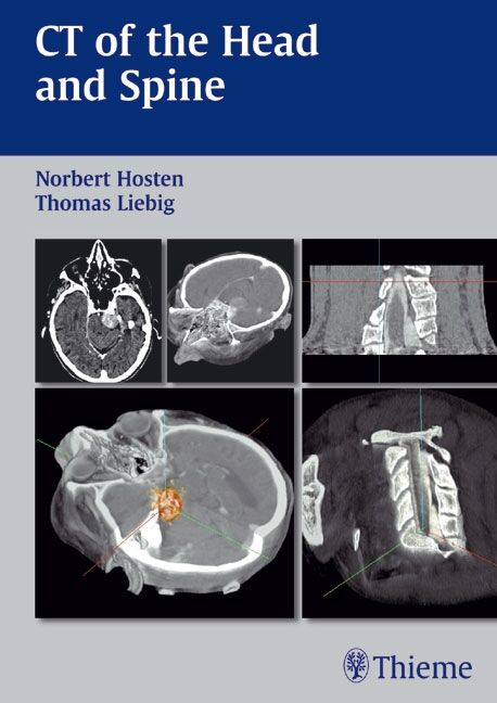 CT of the Head and Spine, 9783132578050
