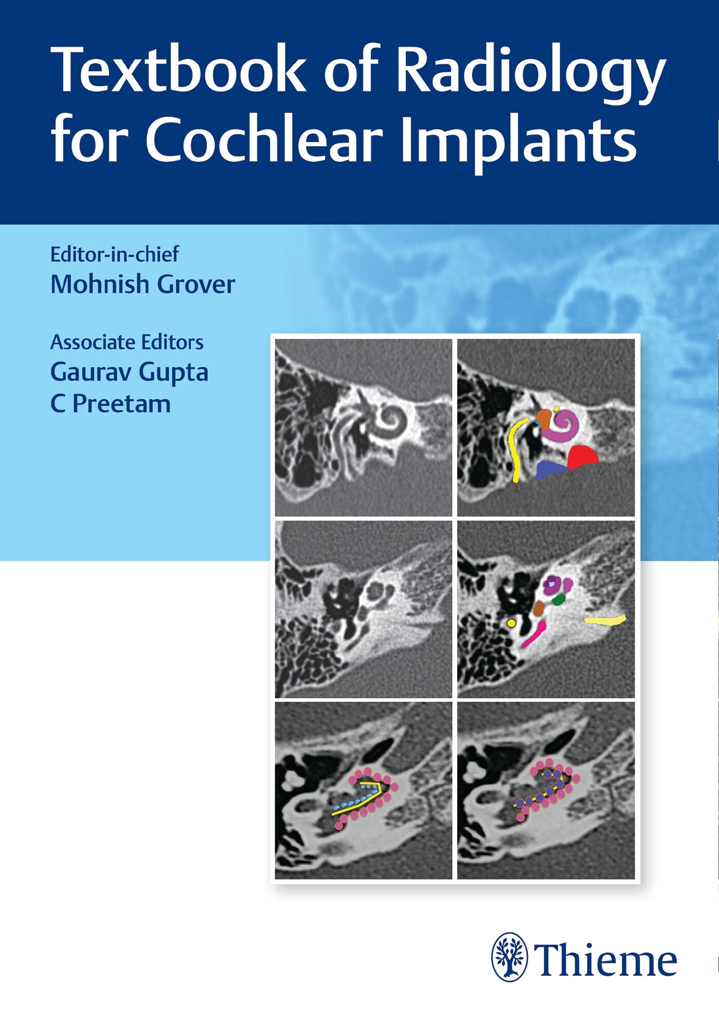 Textbook of Radiology for Cochlear Implants, 9789392819292